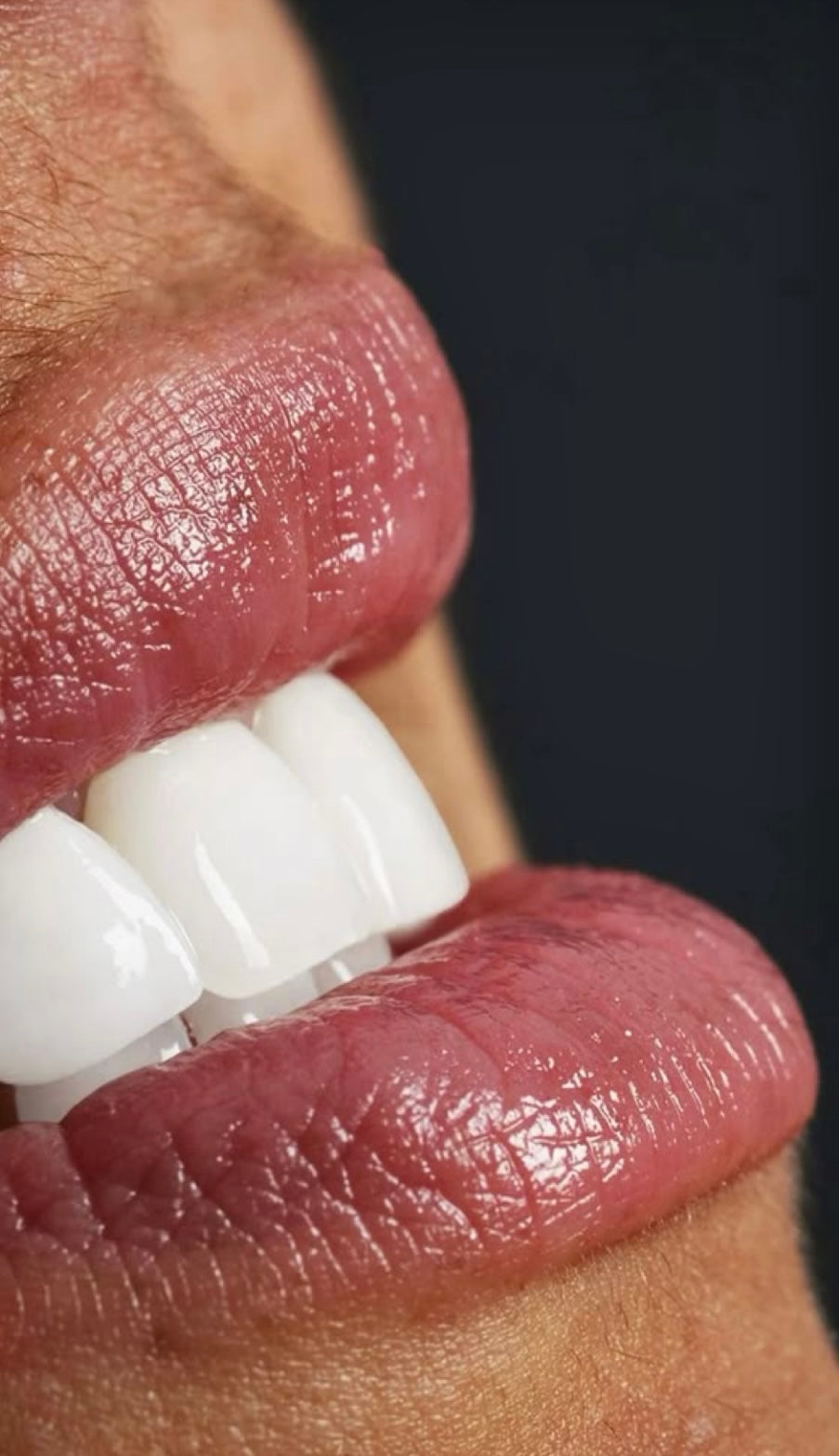 Face-to-face Cosmetic Teeth Whitening Training