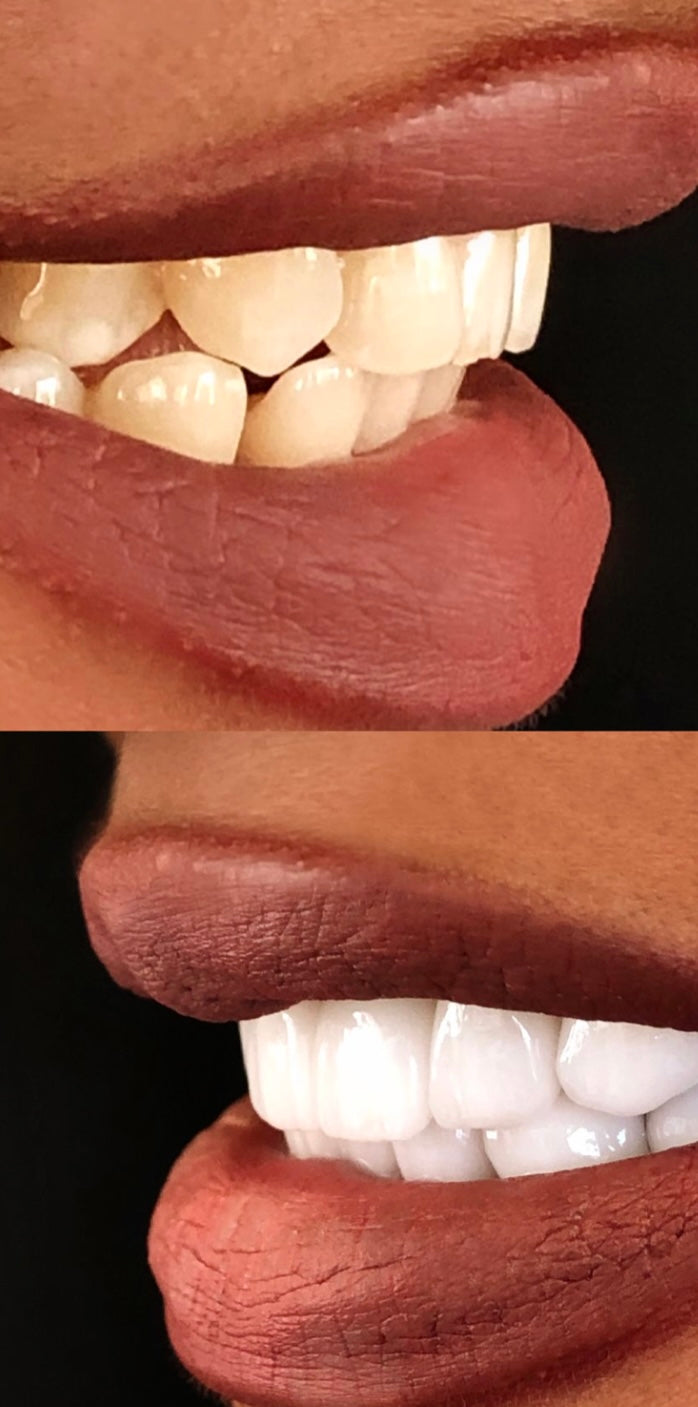 Face-to-face Cosmetic Teeth Whitening Training